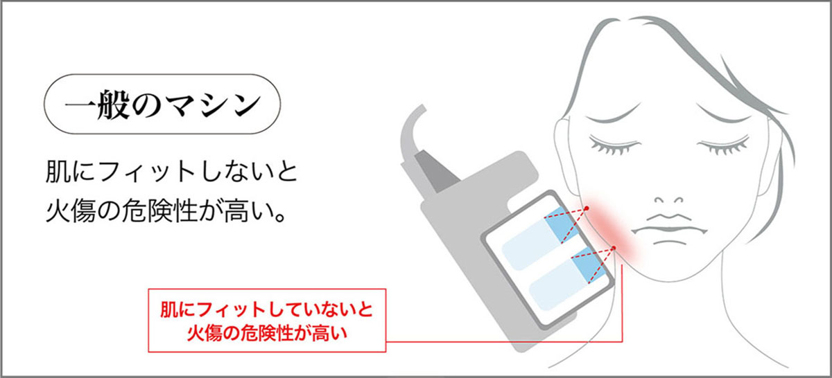 HIFUマシン Focus neo(フォーカスネオ)