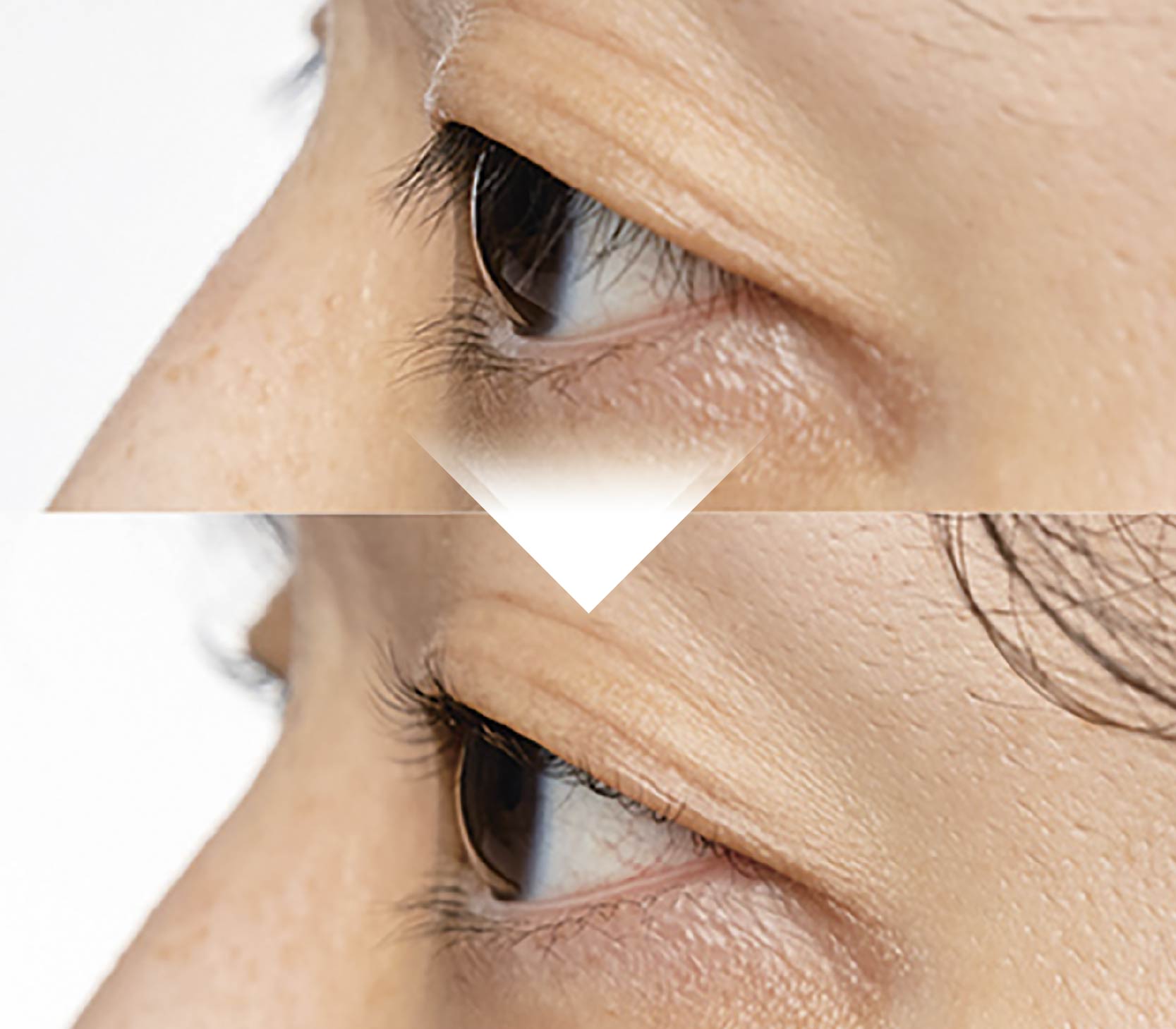 Monter Lash Lift (モンテラッシュリフト)