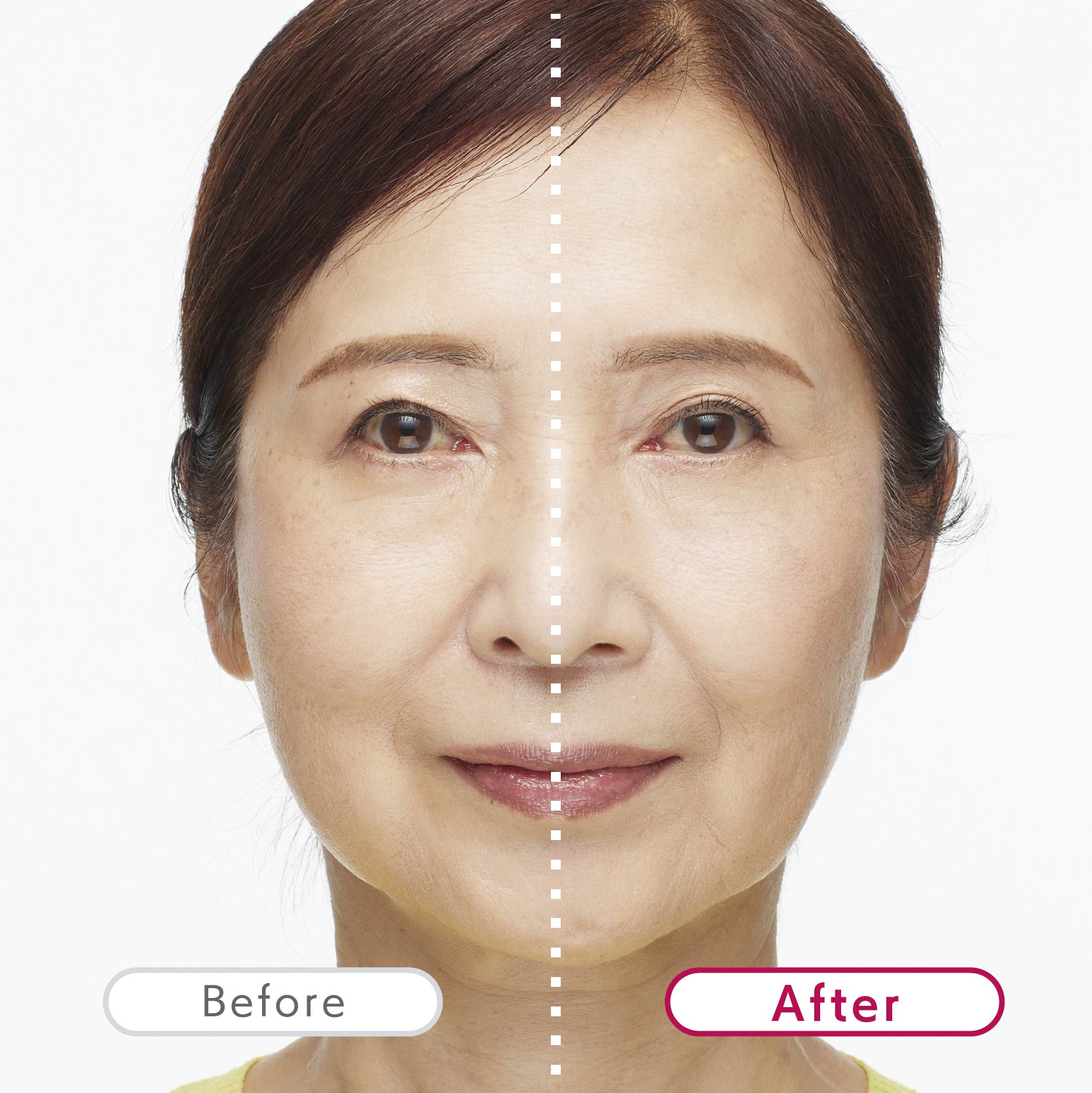 TERAPIST QUMALeSS(テラピスト クマレス)