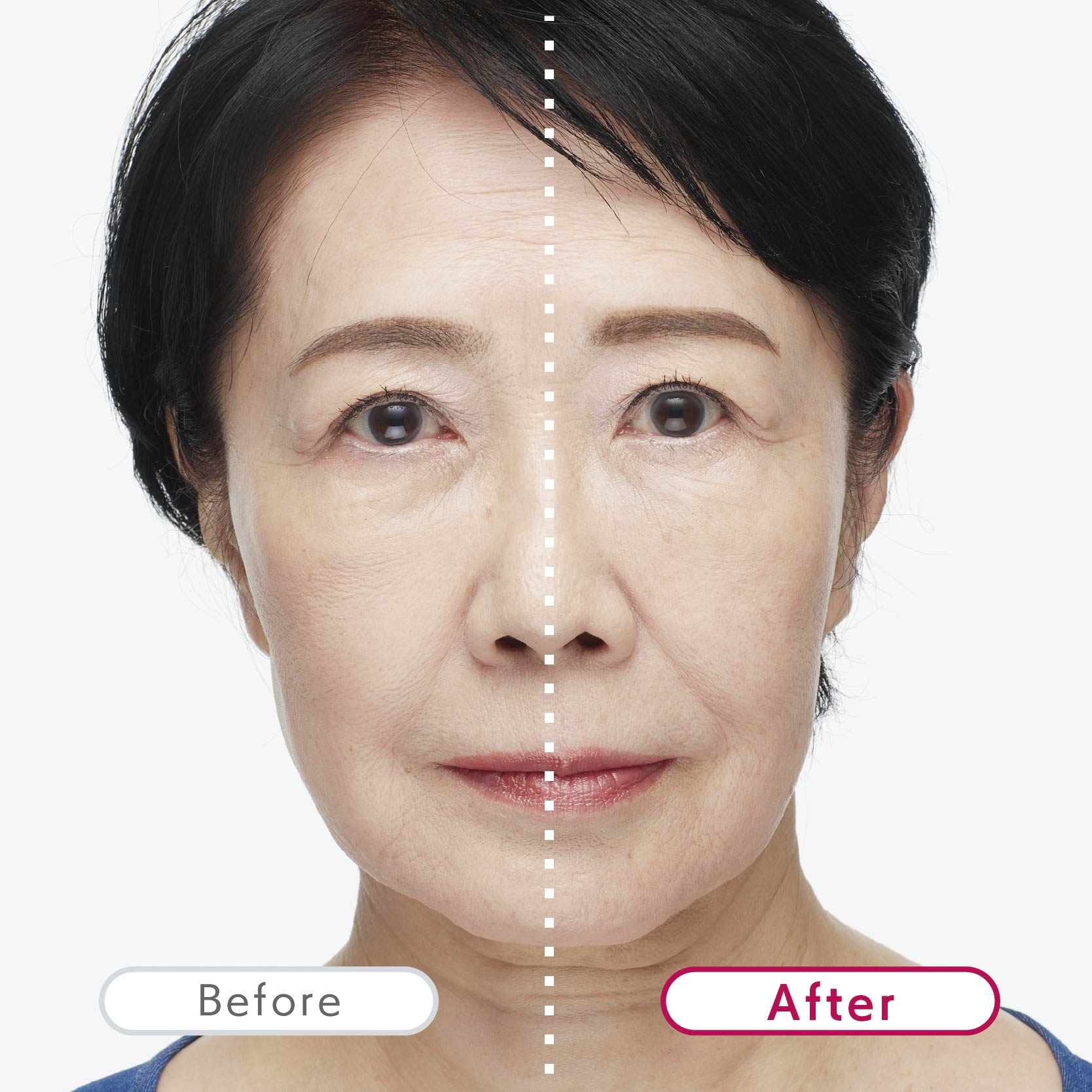 TERAPIST QUMALeSS(テラピスト クマレス)