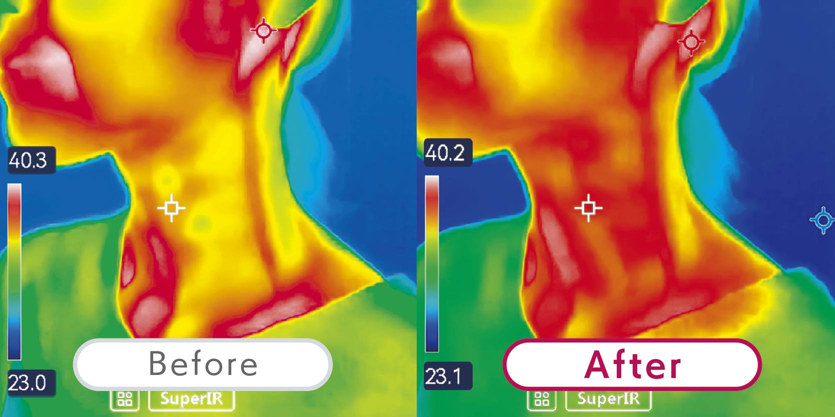 TERAPIST QUMALeSS(テラピスト クマレス)